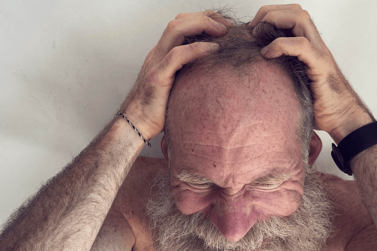 Scalp Dandruff: Causes and What Helps